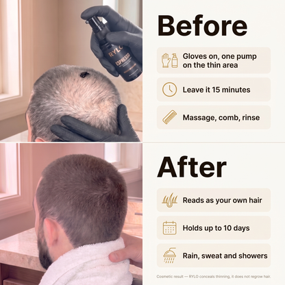 RYLO before and after — gloves on one pump on the thin area, leave it 15 minutes, massage comb rinse; reads as your own hair, holds up to 10 days, rain sweat and showers
